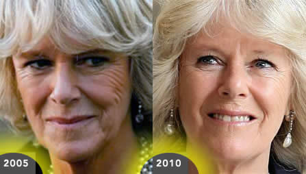 Camilla 2005 and 2010